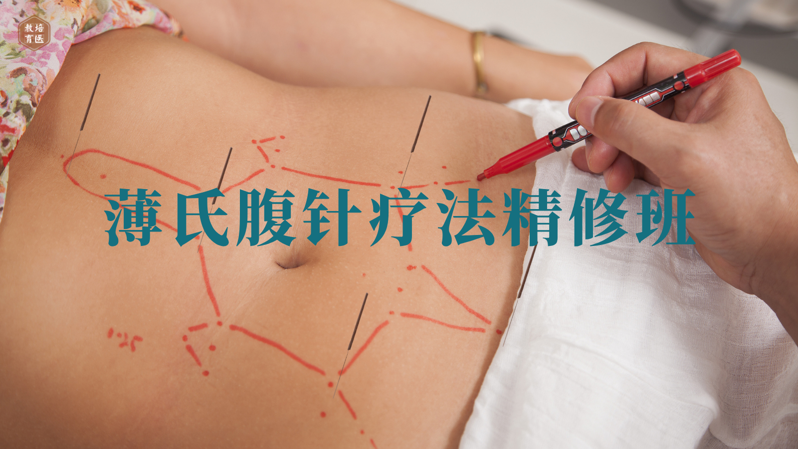 腹针__2025-09-16+13_22_59.png